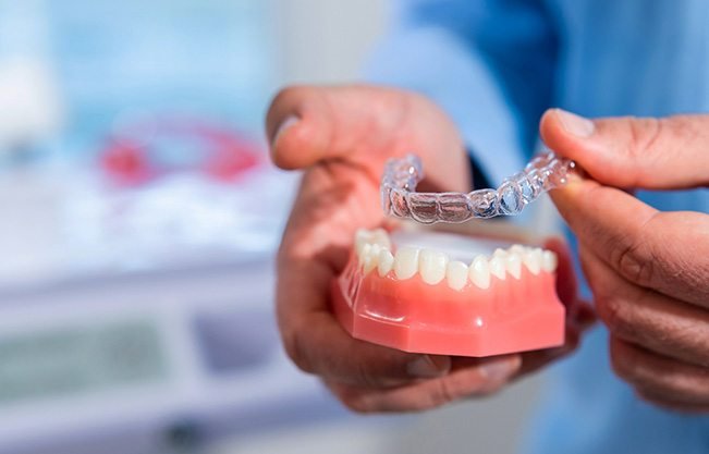 Dentist putting clear aligner on model of teeth