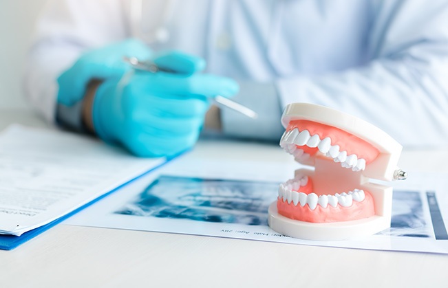 Model of teeth on dentist's desk with X-ray and paperwork