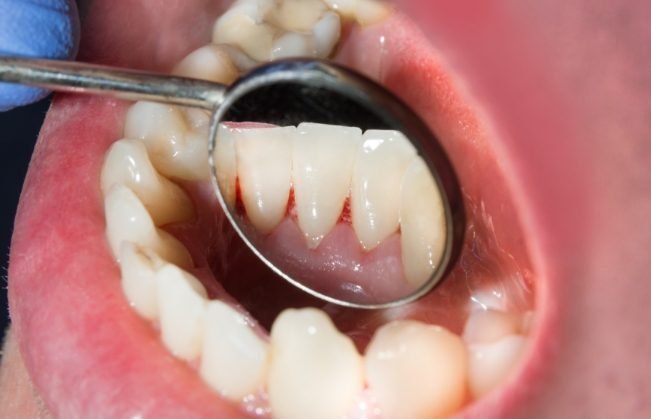 Preventive Dentistry
